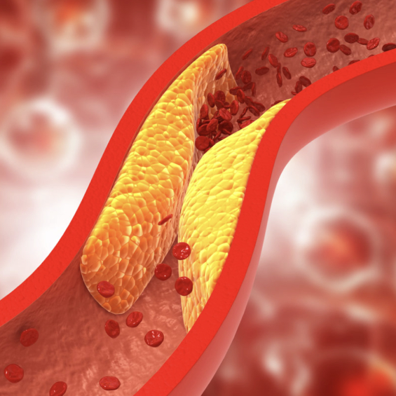  Control y tratamiento  Dislipidemias (Colesterol y Trigliceridos)