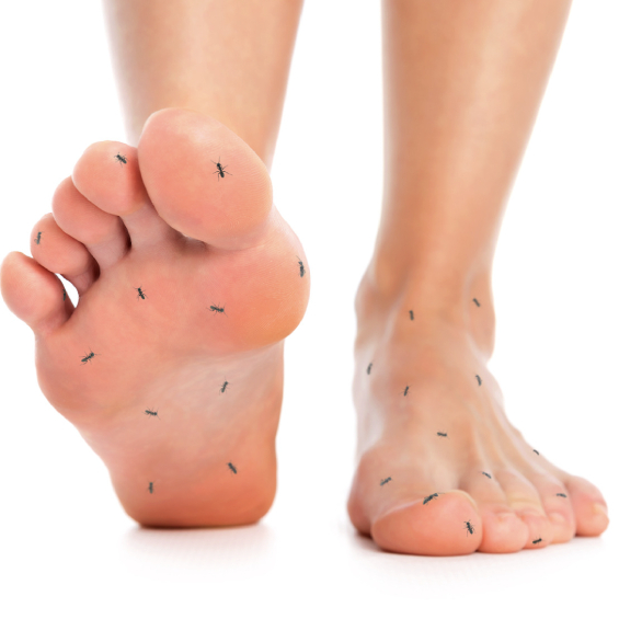 Tratamiento Neuropatia Diabética